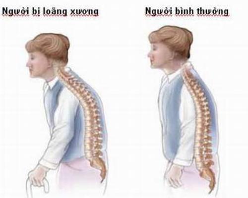 ăn kiêng giảm cân